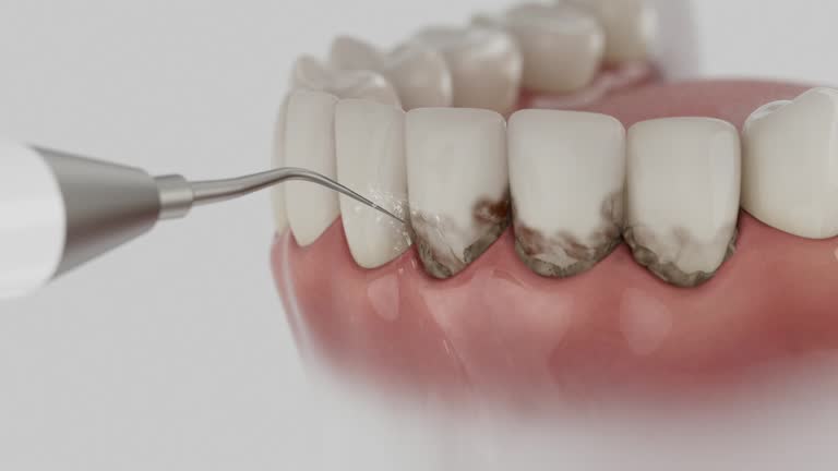 Reliable Dental Implants contractor in Shenandoah, TX by Smile Center Dentistry